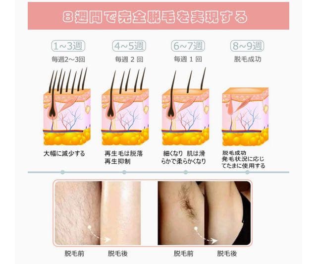 《新品》脱毛器の写真4枚目