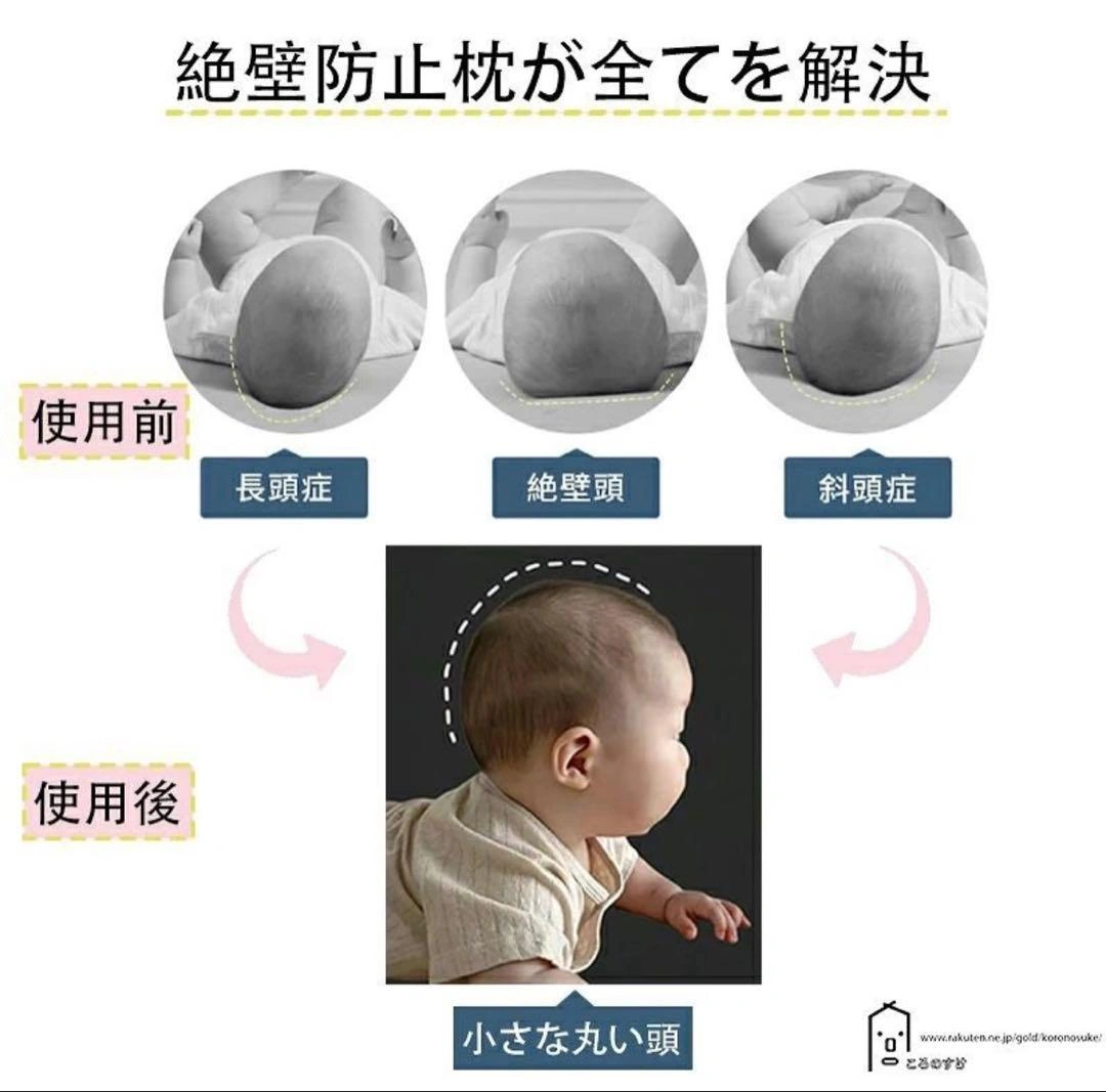 ベビー枕 ドーナツ枕 リバーシブル 洗濯可能 頭 矯正 傾頭症の写真6枚目