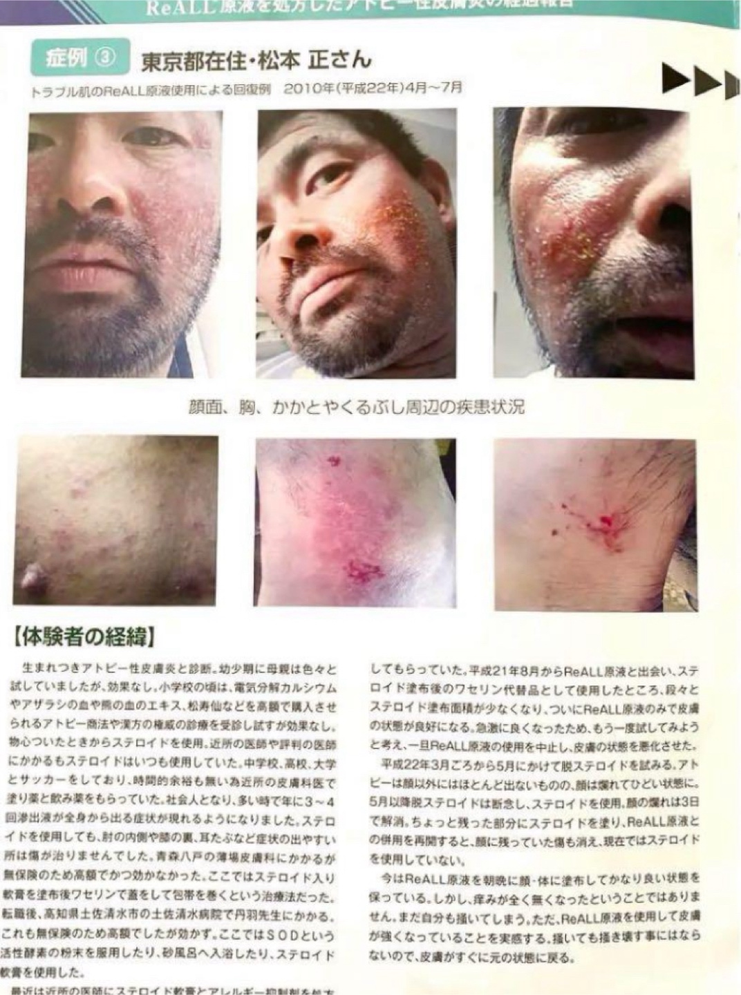 ReALL moisture リオールモイスチャー 美容液の写真3枚目
