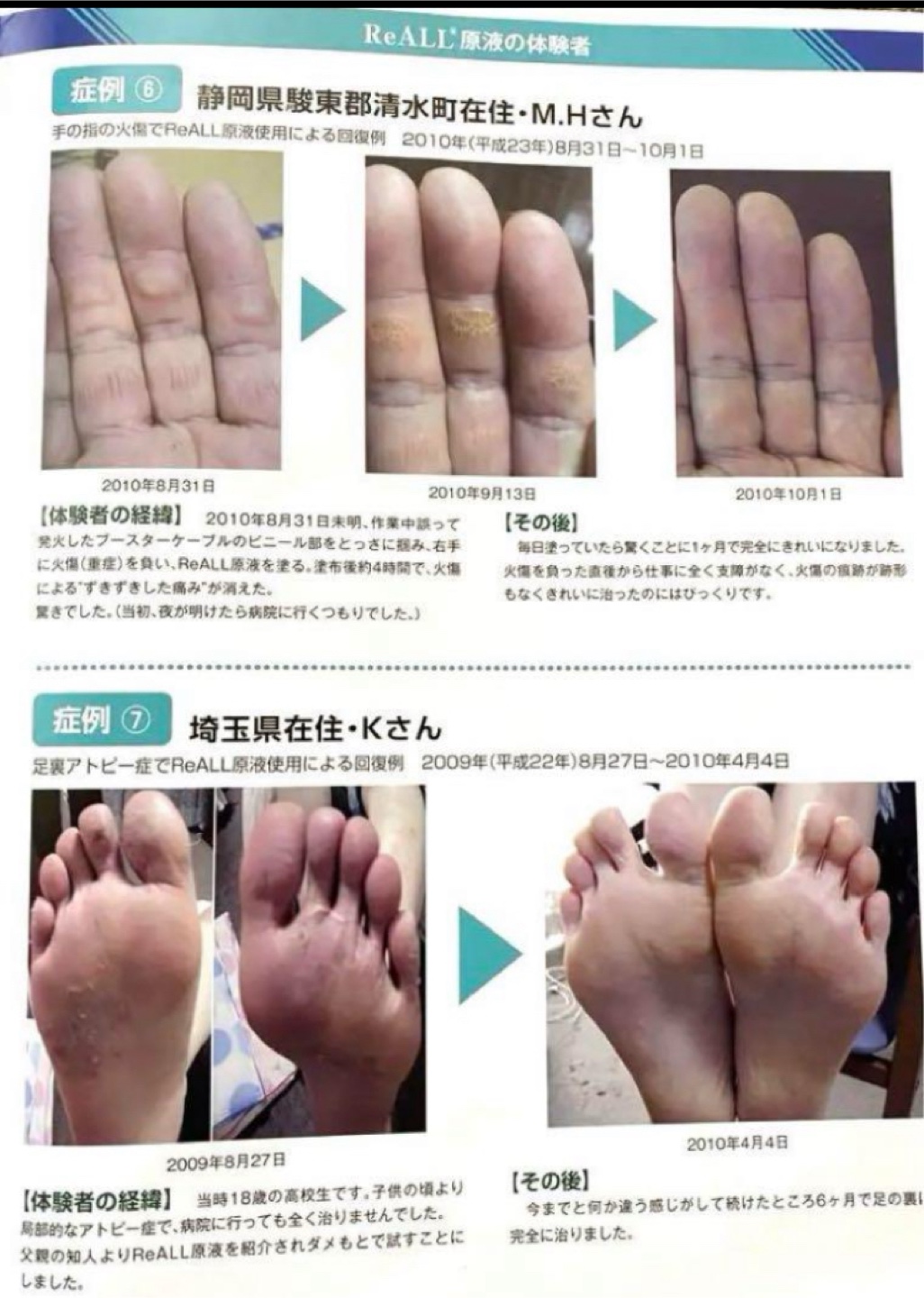 ReALL moisture リオールモイスチャー 美容液の写真5枚目