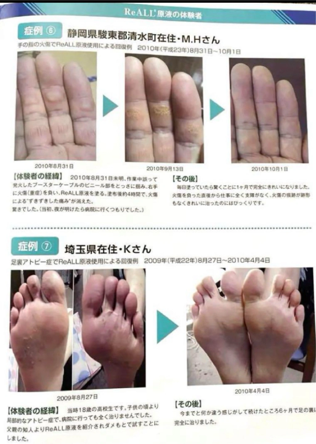 ReALL moisture リオールモイスチャー 美容液の写真5枚目