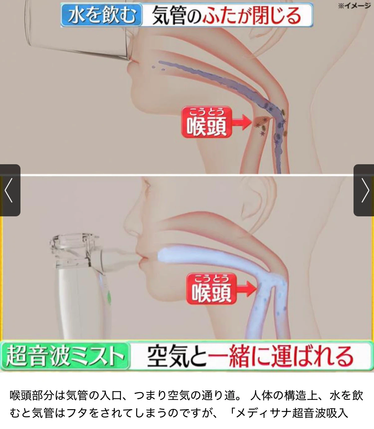 メディサナ 家庭用超音波吸入器 2個セットの写真7枚目